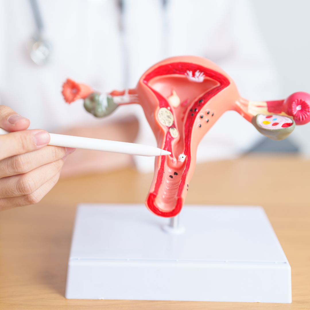 Ini dia penyebab nyeri haid yang normal dan tidak normal